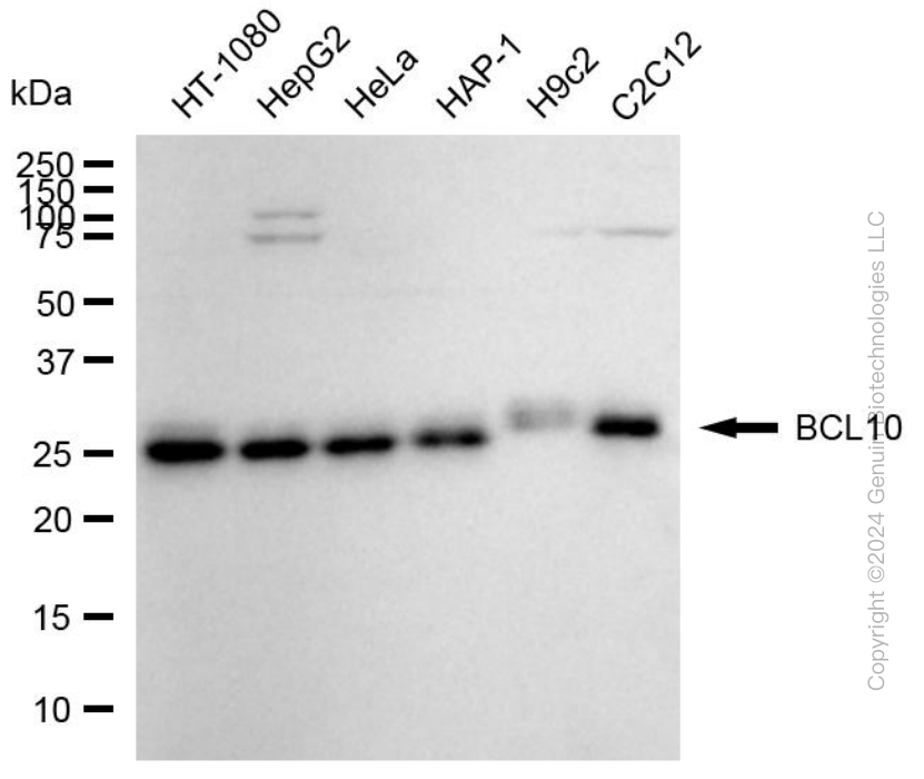 KD-Validated Anti-BCL10 Mouse Monoclonal Antibody ABG1788