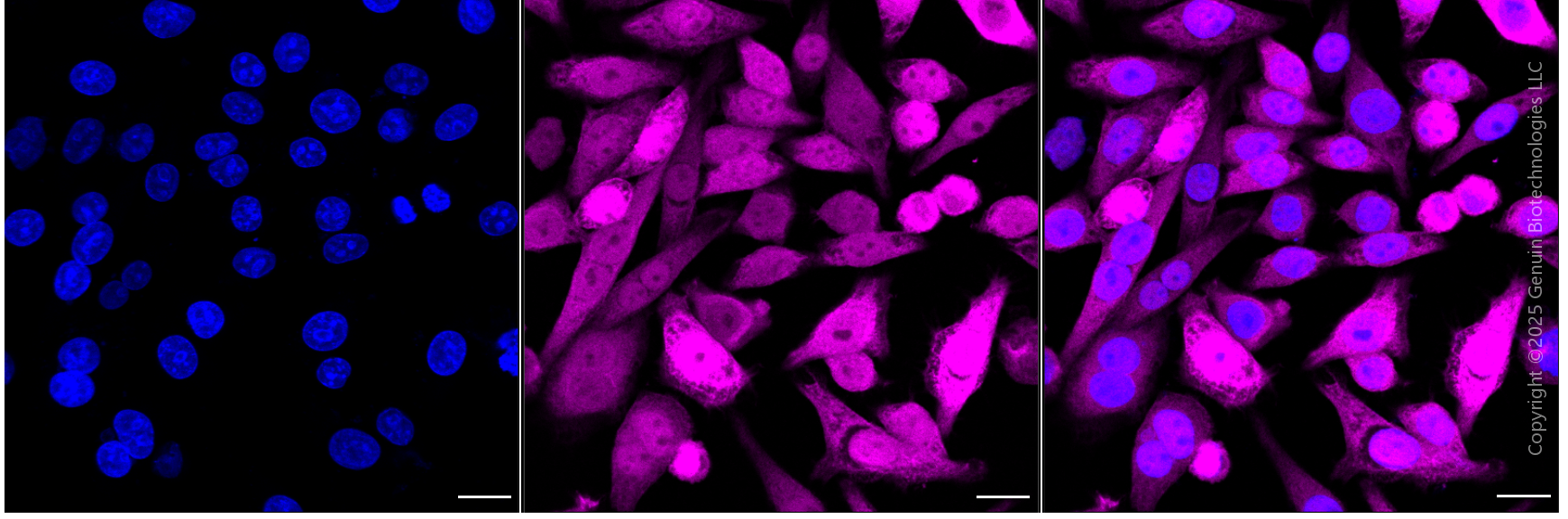 KD-Validated Anti-Phosphoglycerate Kinase 1 Mouse Monoclonal Antibody ABG1789