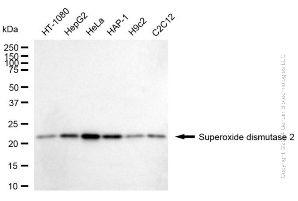 KD-Validated Anti-Superoxide Dismutase 2 Mouse Monoclonal Antibody ABG1791