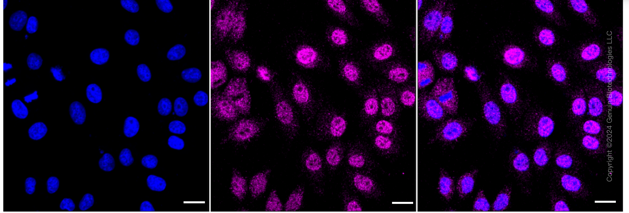 KD-Validated Anti-MTOR Rabbit Monoclonal Antibody ABG1793