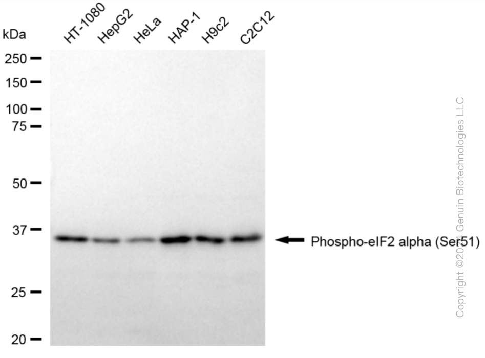 KD-Validated Anti-Phospho-eIF2 alpha (Ser51) Rabbit Monoclonal Antibody ABG1795