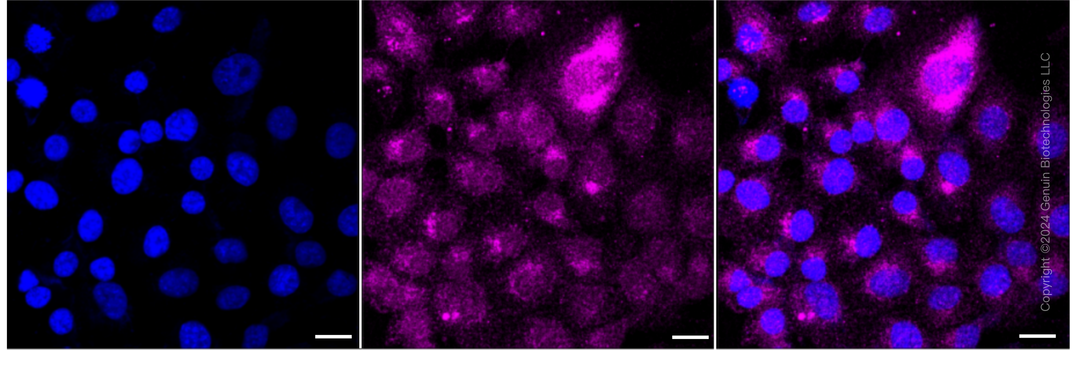 KD-Validated Anti-Serpin Family E Member 1 Rabbit Monoclonal Antibody ABG1796