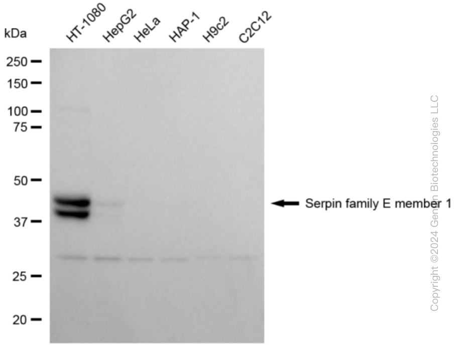 KD-Validated Anti-Serpin Family E Member 1 Rabbit Monoclonal Antibody ABG1796
