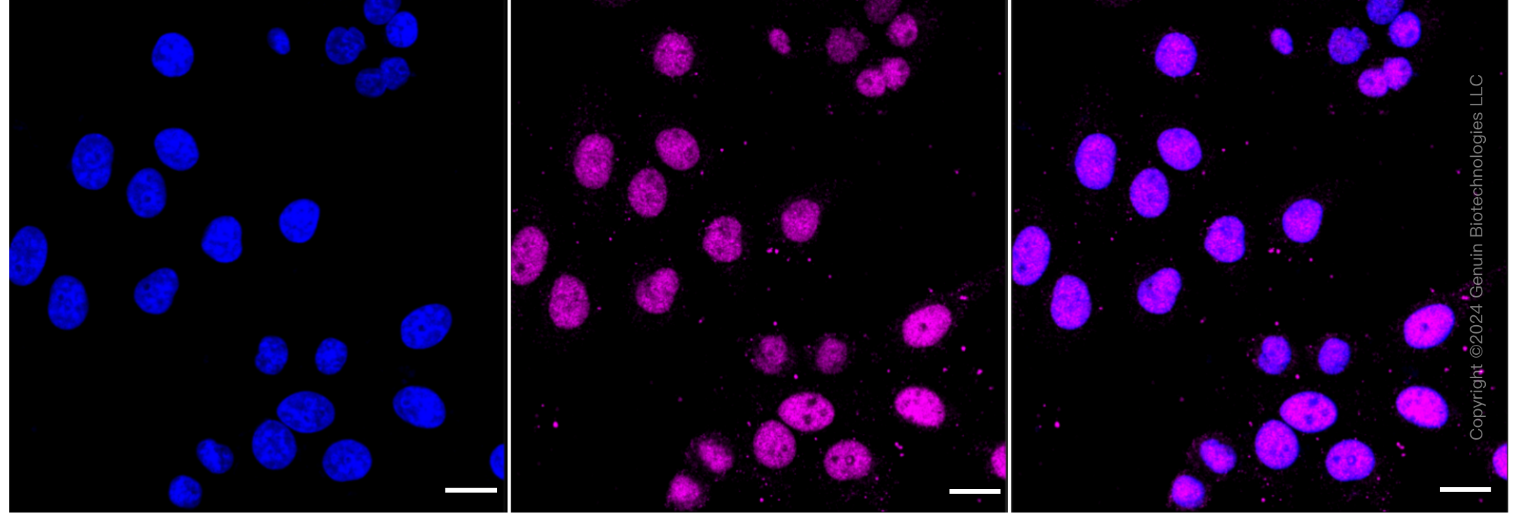 KD-Validated Anti-DNA Methyltransferase 1 Rabbit Monoclonal Antibody ABG1798
