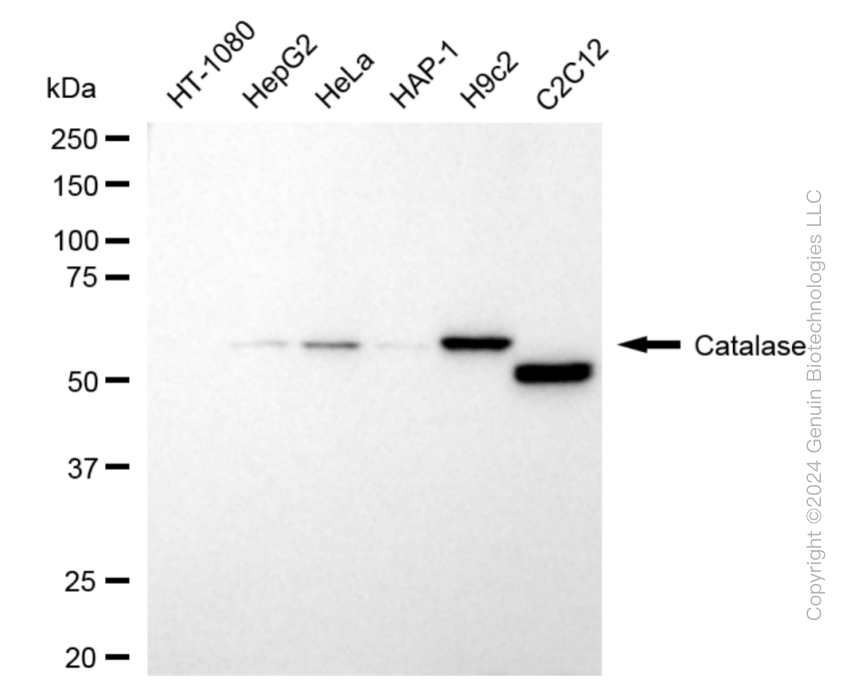 KD-Validated Anti-Catalase Rabbit Monoclonal Antibody ABG1802