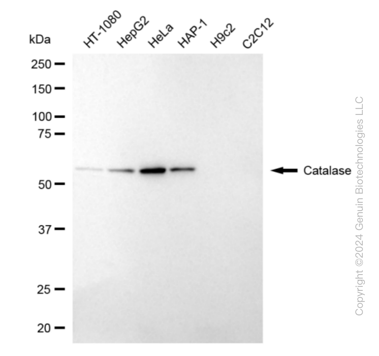 KD-Validated Anti-Catalase Rabbit Monoclonal Antibody ABG1803
