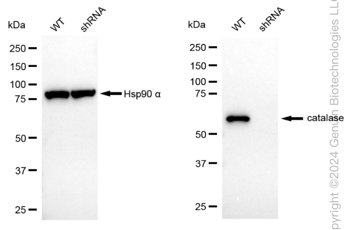 KD-Validated Anti-Catalase Rabbit Monoclonal Antibody ABG1803