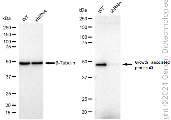 KD-Validated Anti-Growth associated protein 43 Rabbit Monoclonal Antibody ABG1808