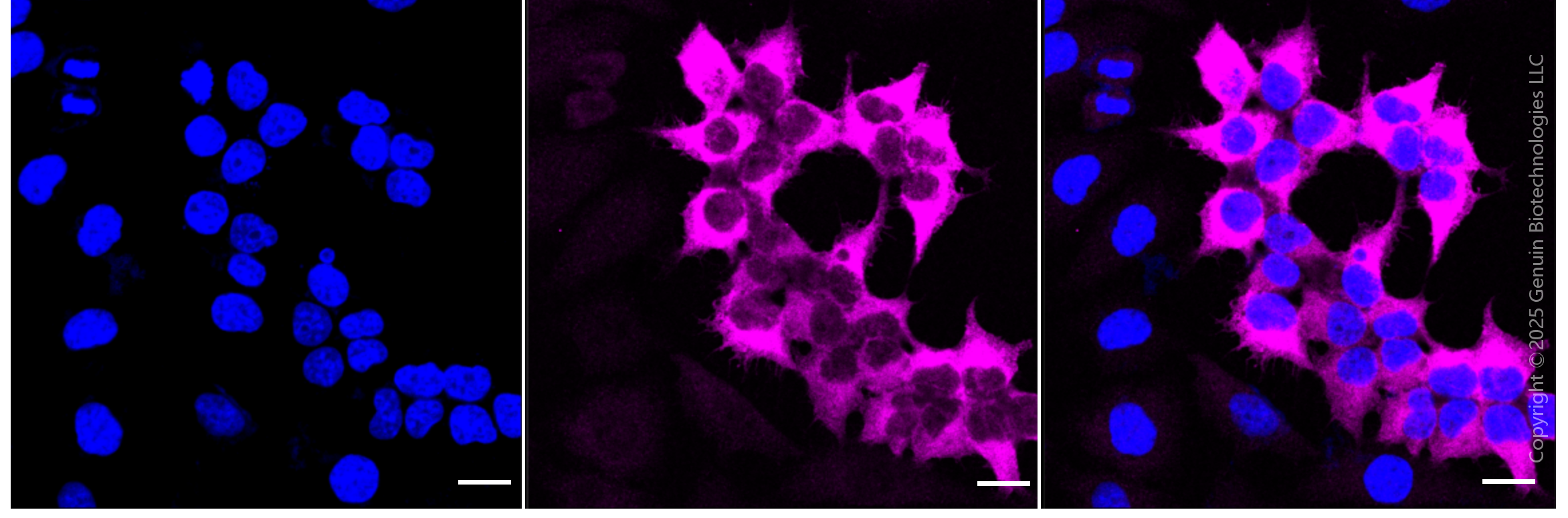 KD-Validated Anti-Creatine Kinase B type Rabbit Monoclonal Antibody ABG1809