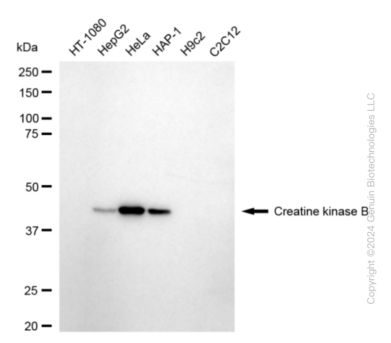 KD-Validated Anti-Creatine Kinase B type Rabbit Monoclonal Antibody ABG1809