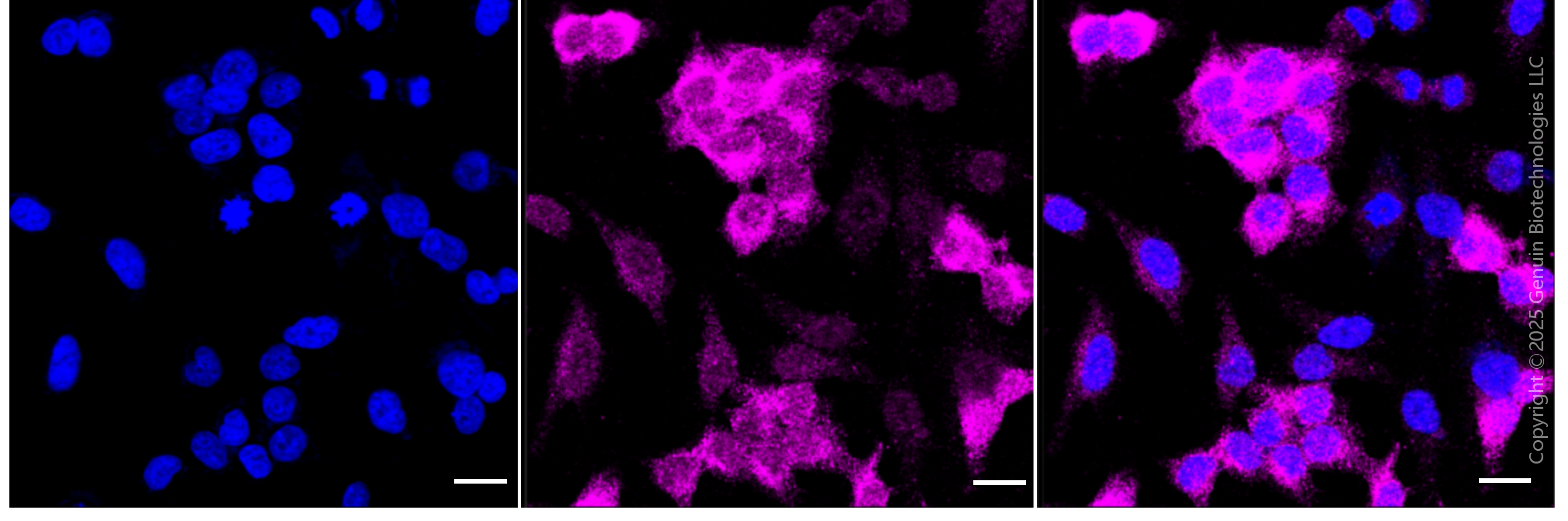 KD-Validated Anti-Creatine Kinase B type Rabbit Monoclonal Antibody ABG1811