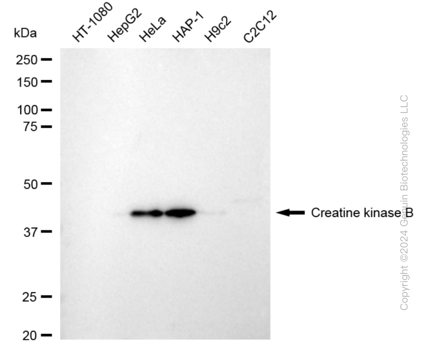 KD-Validated Anti-Creatine Kinase B type Rabbit Monoclonal Antibody ABG1811