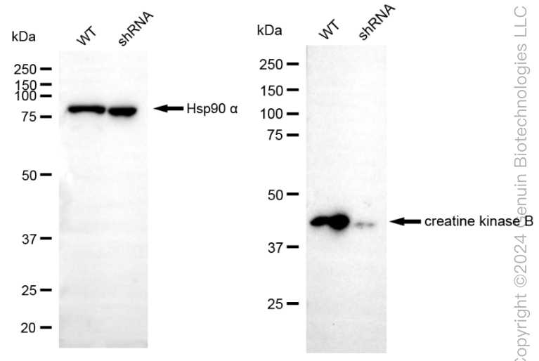 KD-Validated Anti-Creatine Kinase B type Rabbit Monoclonal Antibody ABG1811