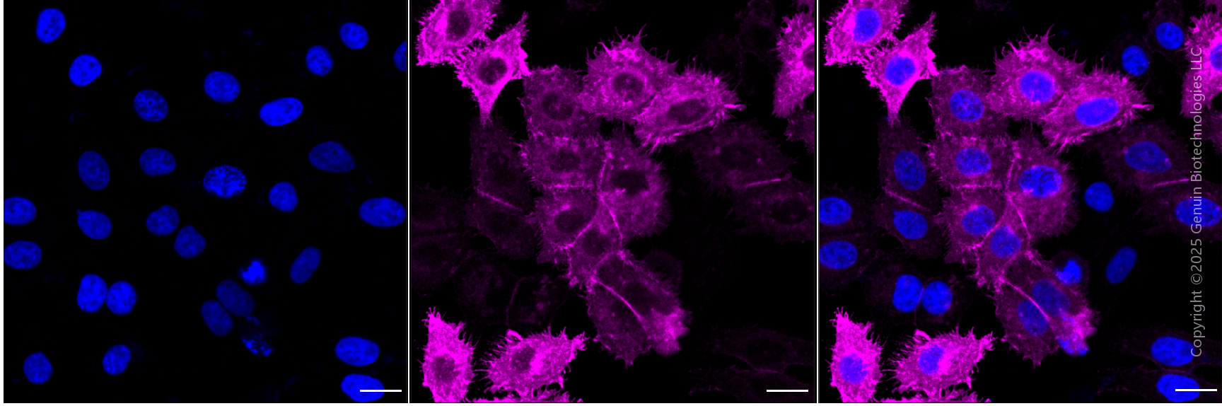 KD-Validated Anti-Epidermal Growth Factor Receptor Rabbit Monoclonal Antibody ABG1812