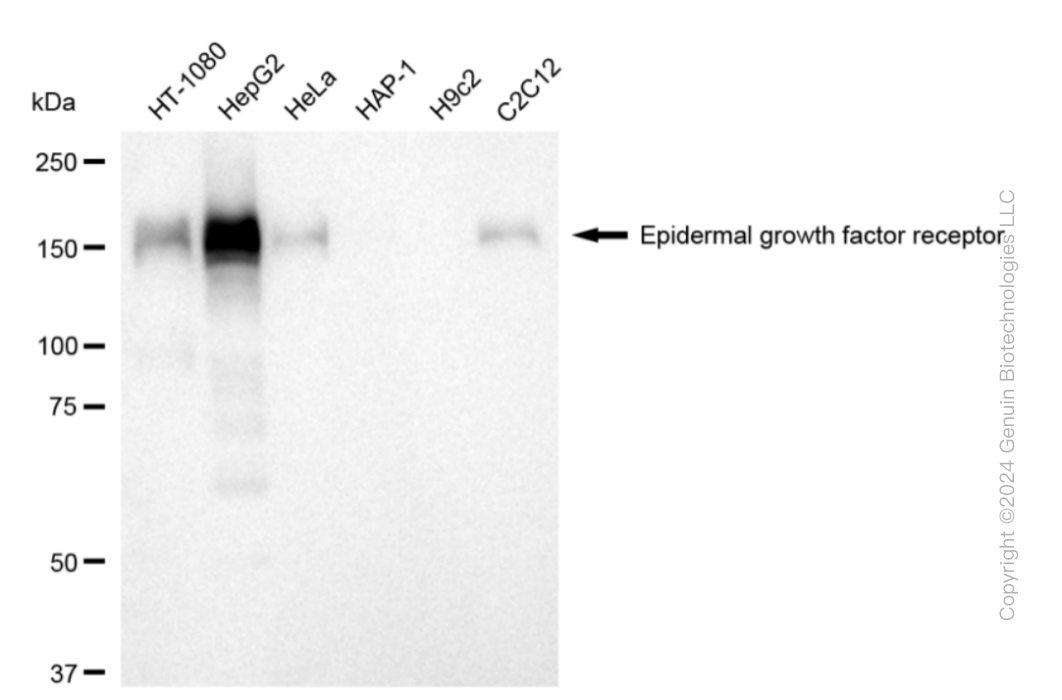 KD-Validated Anti-Epidermal Growth Factor Receptor Rabbit Monoclonal Antibody ABG1812