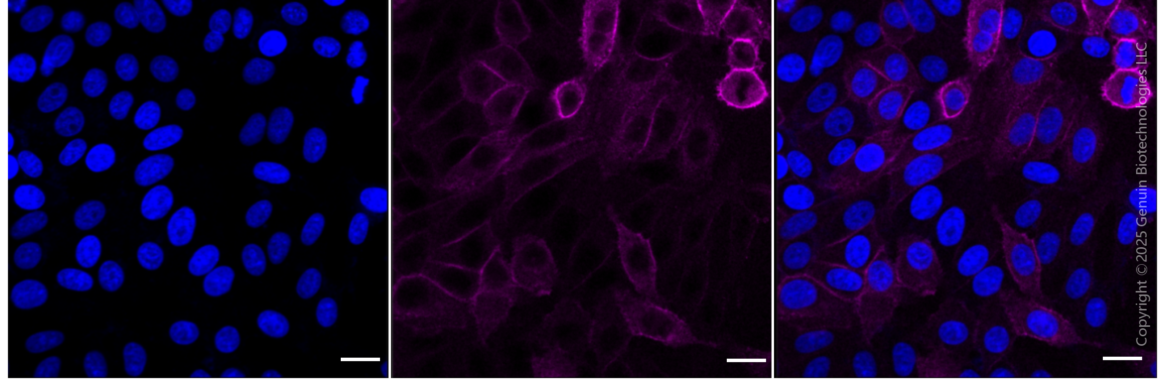 KD-Validated Anti-Epidermal Growth Factor Receptor Rabbit Monoclonal Antibody ABG1813