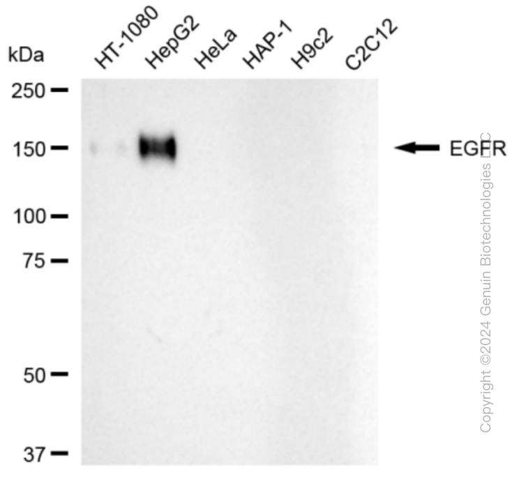 KD-Validated Anti-Epidermal Growth Factor Receptor Rabbit Monoclonal Antibody ABG1813