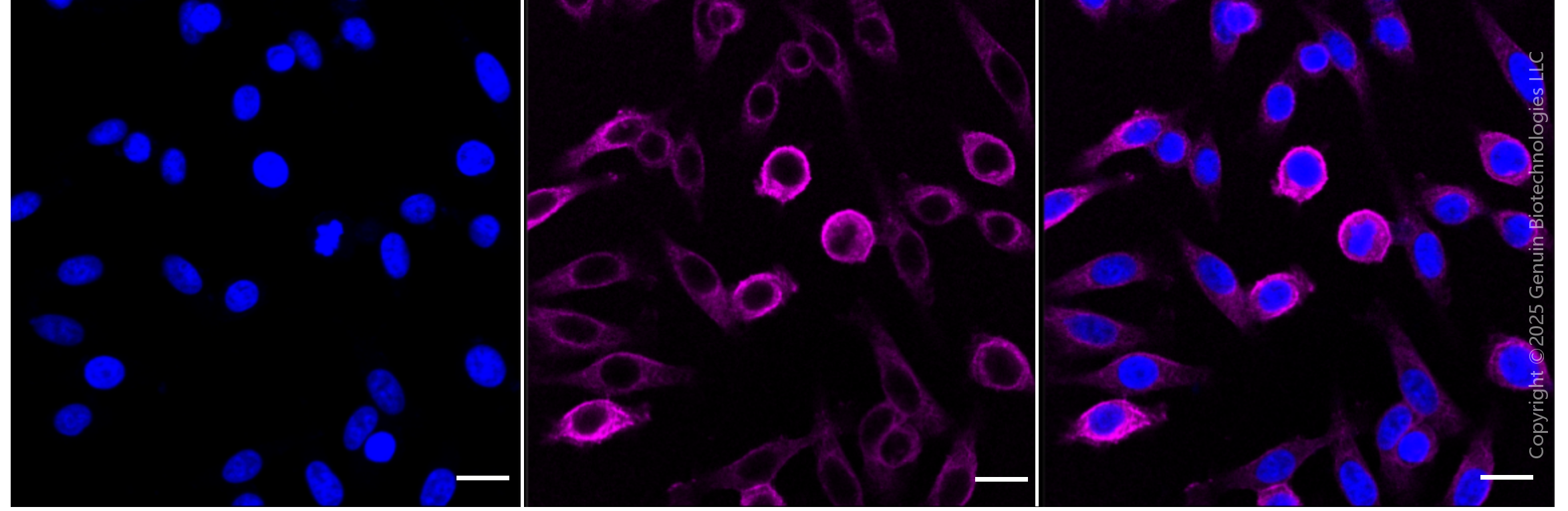KD-Validated Anti-Epidermal Growth Factor Receptor Rabbit Monoclonal Antibody ABG1814