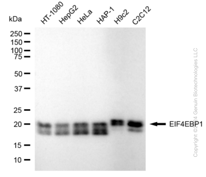 KD-Validated Anti-EIF4EBP1 Rabbit Monoclonal Antibody ABG1816