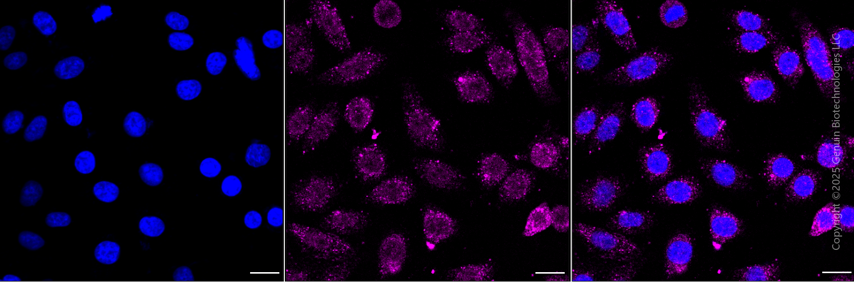 KD-Validated Anti-Integrin alpha V Rabbit Monoclonal Antibody ABG1819