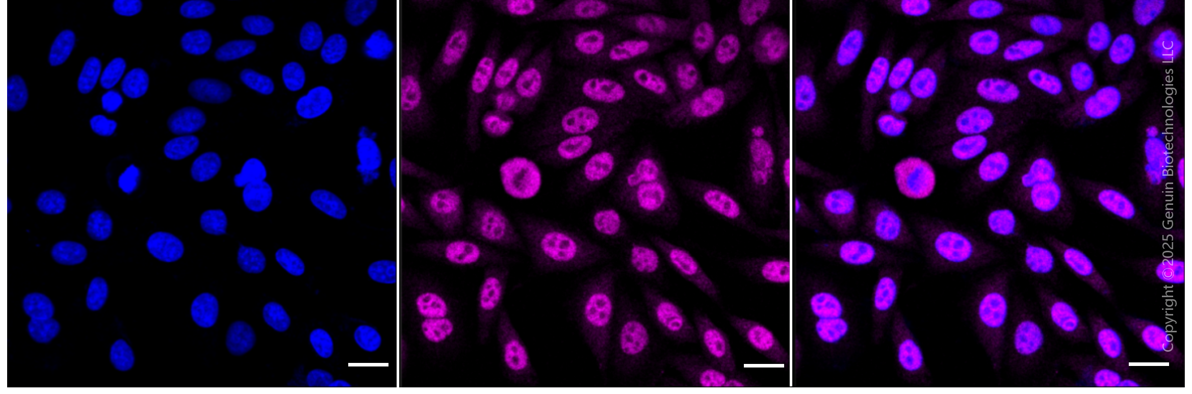 KD-Validated Anti-Phospho-PKC alpha (Thr638) Rabbit Monoclonal Antibody ABG1821