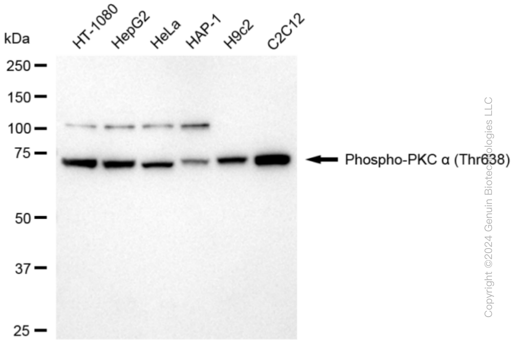 KD-Validated Anti-Phospho-PKC alpha (Thr638) Rabbit Monoclonal Antibody ABG1821
