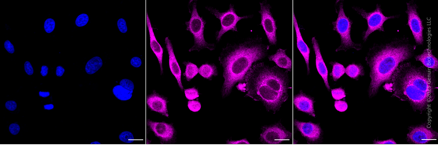 KD-Validated Anti-Protein Kinase C Alpha Rabbit Monoclonal Antibody ABG1822