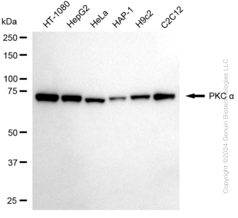 KD-Validated Anti-Protein Kinase C Alpha Rabbit Monoclonal Antibody ABG1822