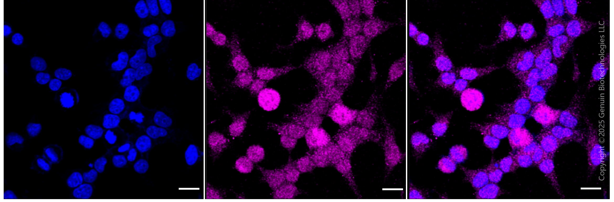 KD-Validated Anti-Phospho-Presenilin 1 (Ser310) Rabbit Monoclonal Antibody ABG1825