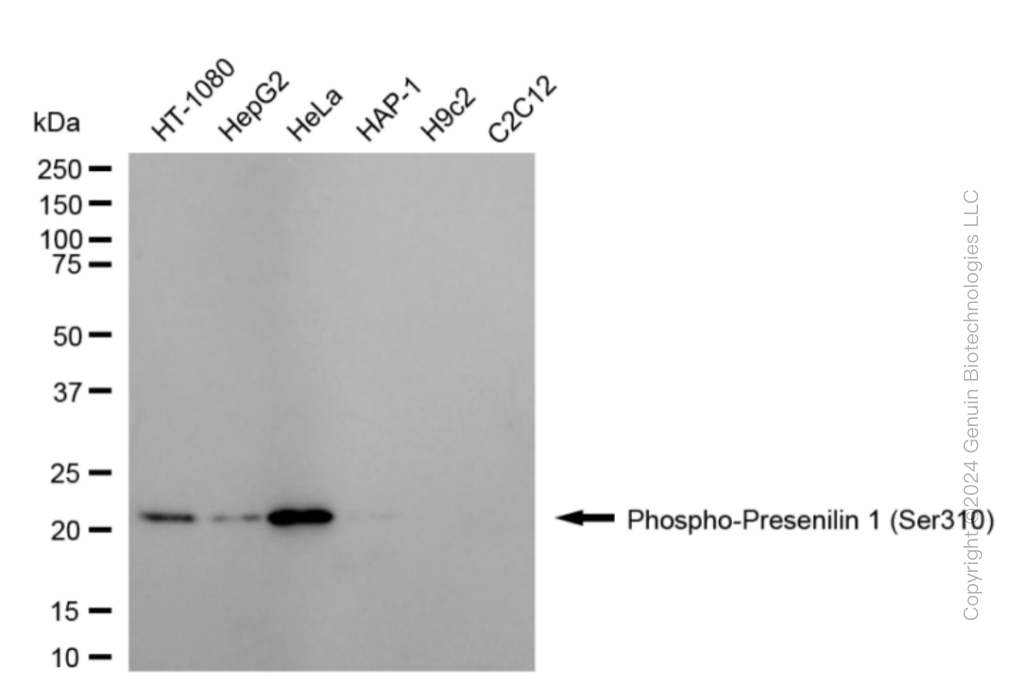 KD-Validated Anti-Phospho-Presenilin 1 (Ser310) Rabbit Monoclonal Antibody ABG1825