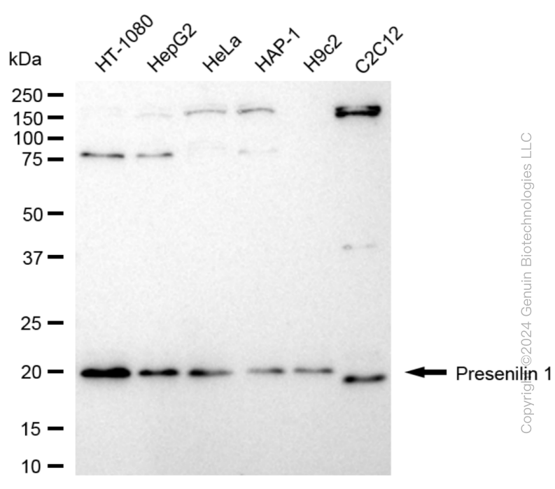 KD-Validated Anti-Presenilin 1 Rabbit Monoclonal Antibody ABG1826
