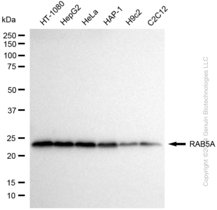 KD-Validated Anti-RAB5A Rabbit Monoclonal Antibody ABG1827