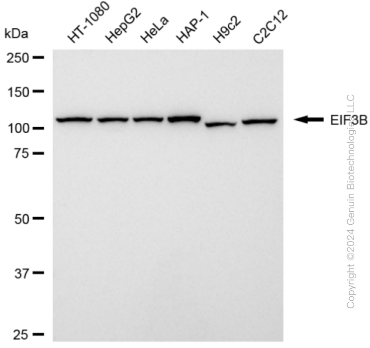 KD-Validated Anti-EIF3B Rabbit Monoclonal Antibody ABG1829