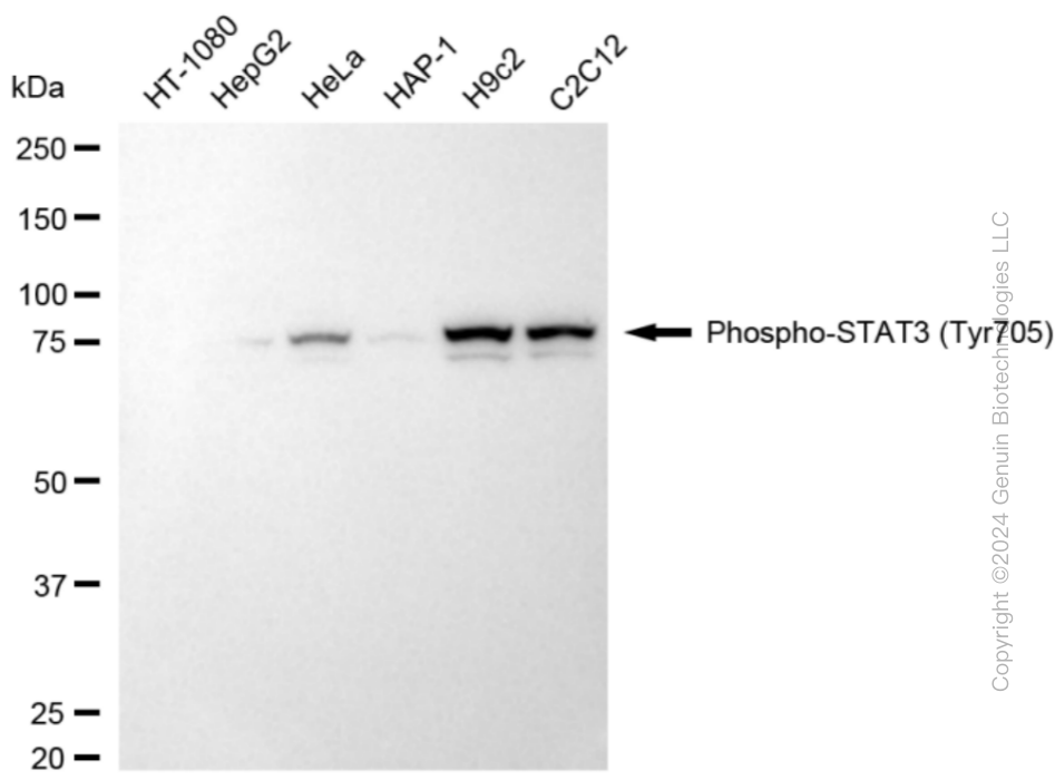 KD-Validated Anti-Phospho-STAT3 (Tyr705) Rabbit Monoclonal Antibody ABG1842