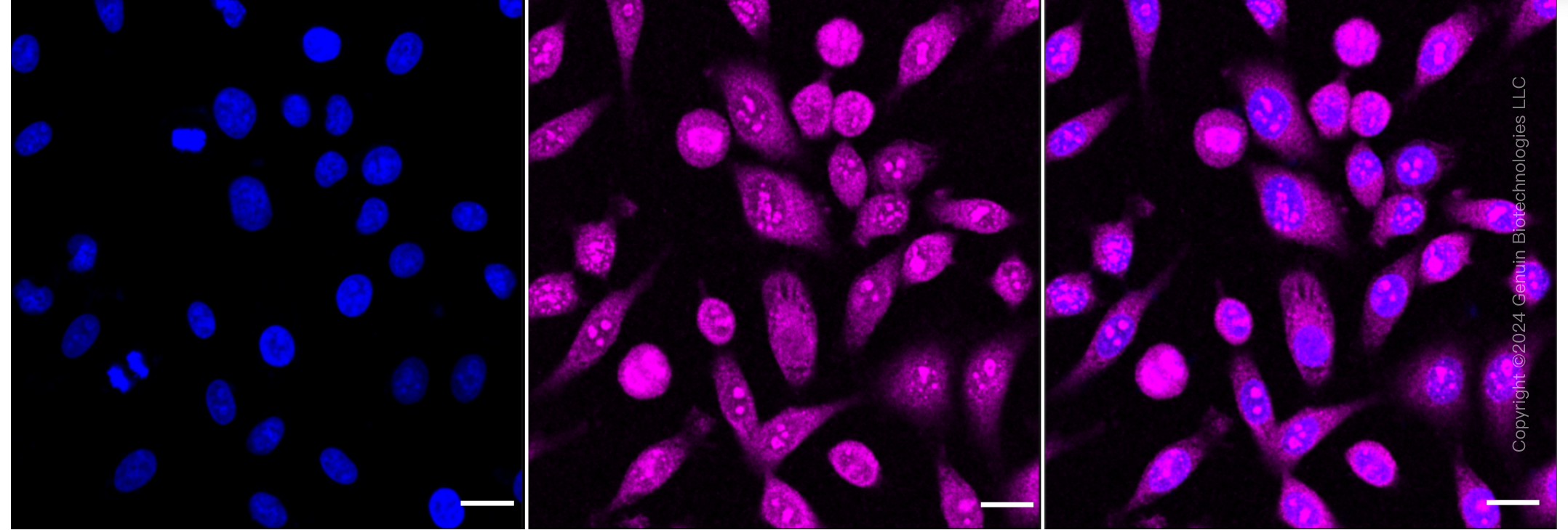 KD-Validated Anti-TANK Binding Kinase 1 Rabbit Monoclonal Antibody ABG1843