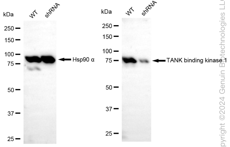 KD-Validated Anti-TANK Binding Kinase 1 Rabbit Monoclonal Antibody ABG1843