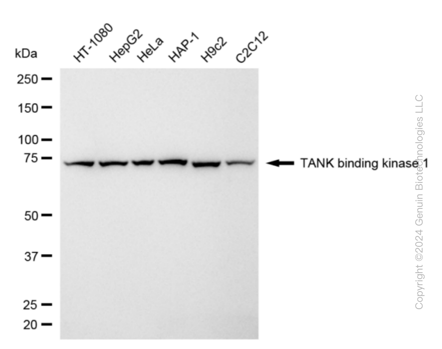 KD-Validated Anti-TANK Binding Kinase 1 Rabbit Monoclonal Antibody ABG1844