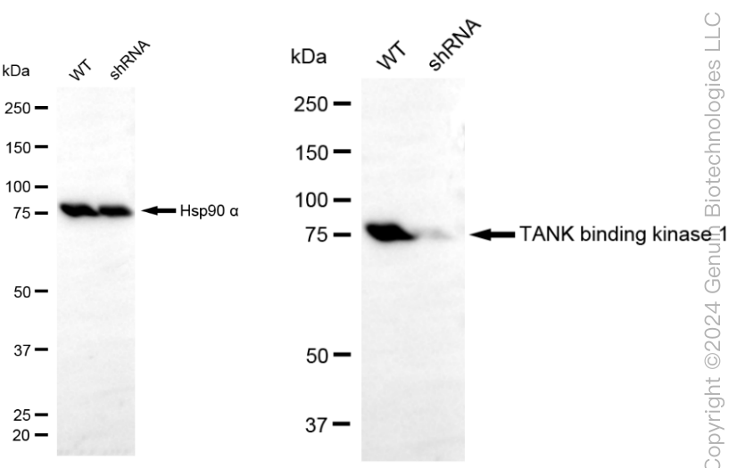 KD-Validated Anti-TANK Binding Kinase 1 Rabbit Monoclonal Antibody ABG1844