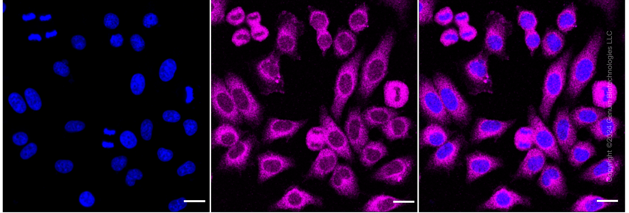 KD-Validated Anti-TANK Binding Kinase 1 Rabbit Monoclonal Antibody ABG1845