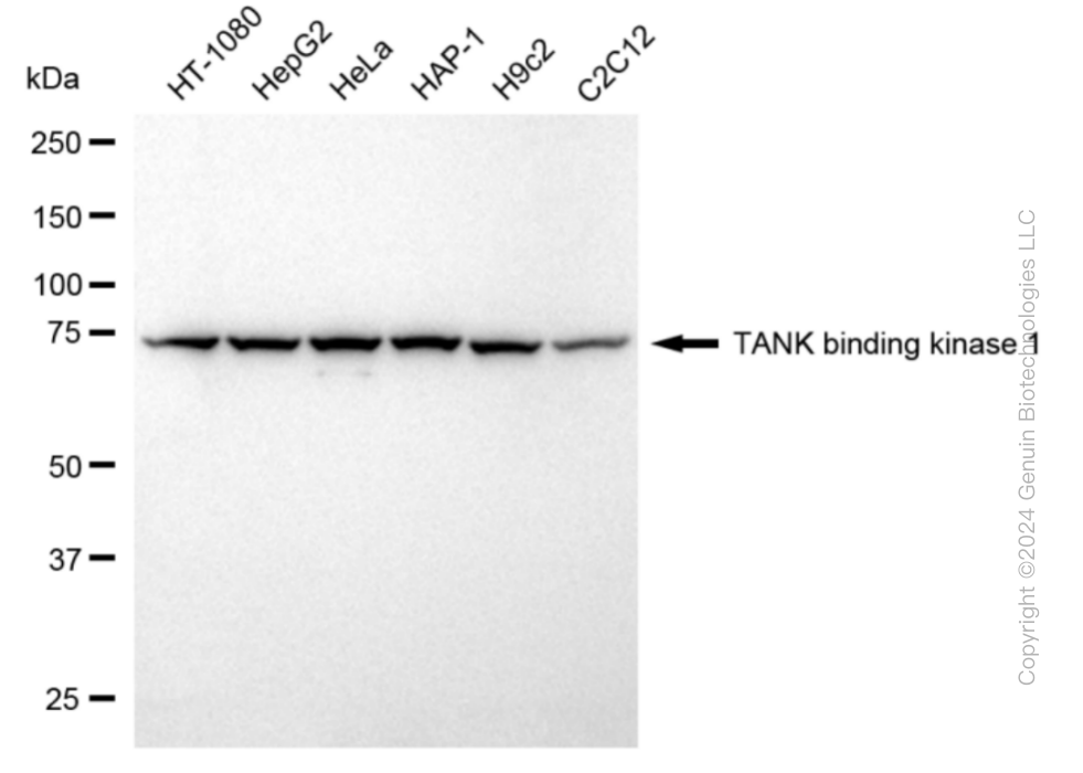KD-Validated Anti-TANK Binding Kinase 1 Rabbit Monoclonal Antibody ABG1845