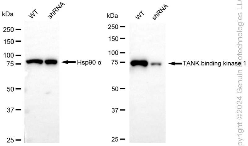 KD-Validated Anti-TANK Binding Kinase 1 Rabbit Monoclonal Antibody ABG1845