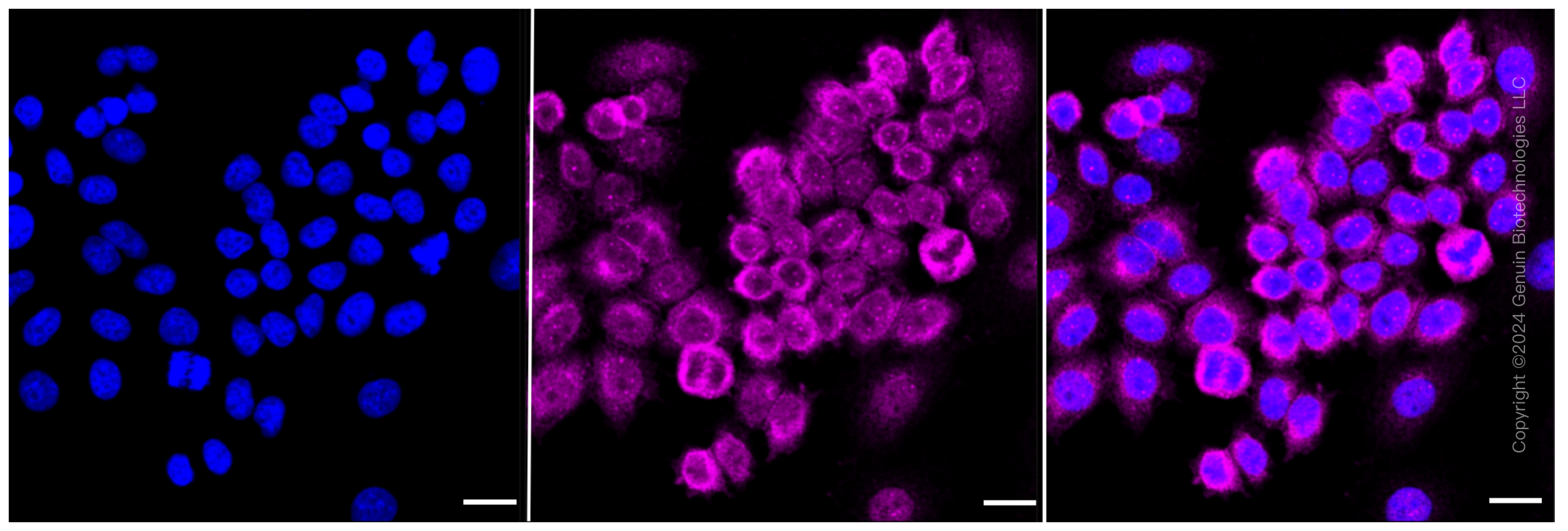 KD-Validated Anti-NF-kB p65 Rabbit Monoclonal Antibody ABG1846