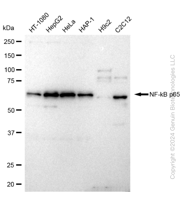 KD-Validated Anti-NF-kB p65 Rabbit Monoclonal Antibody ABG1846