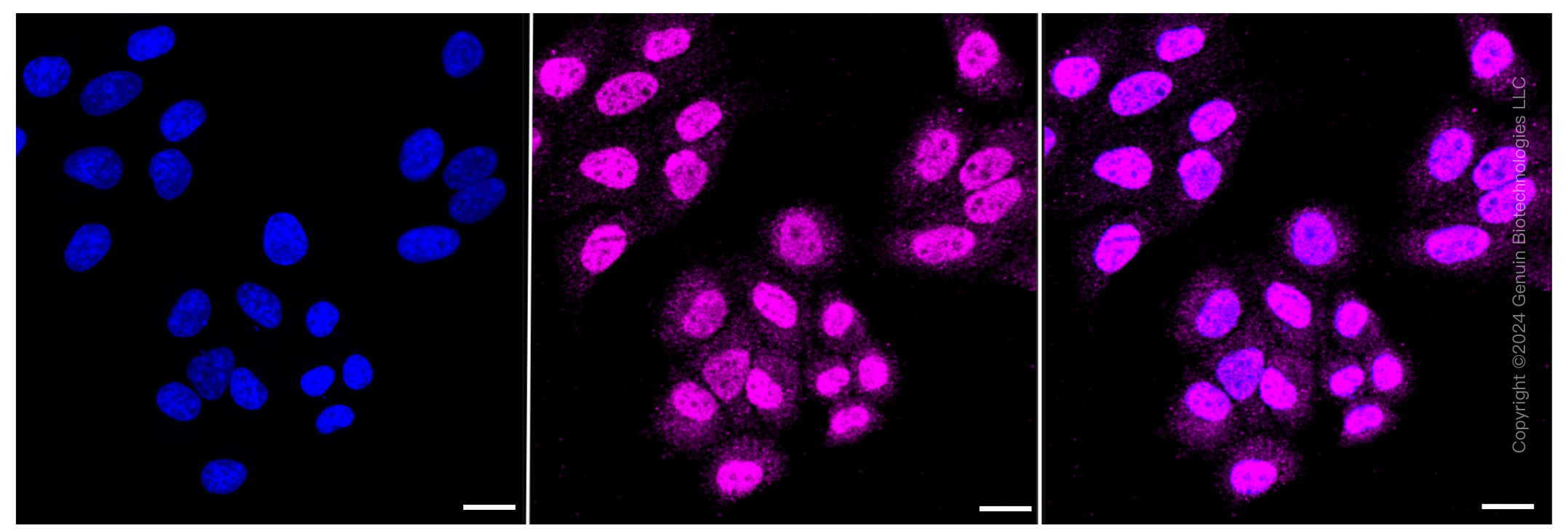 KD-Validated Anti-HDAC4 Rabbit Monoclonal Antibody ABG1848