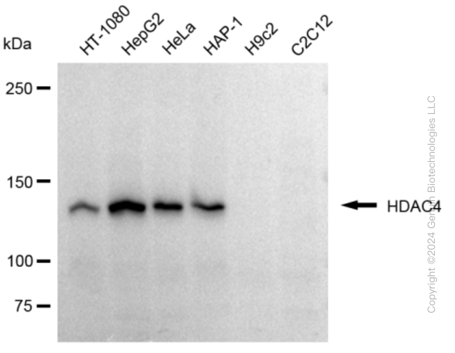 KD-Validated Anti-HDAC4 Rabbit Monoclonal Antibody ABG1848