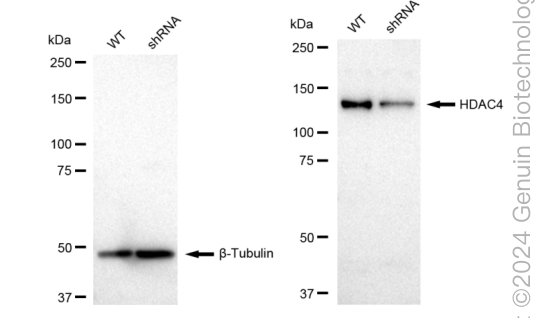 KD-Validated Anti-HDAC4 Rabbit Monoclonal Antibody ABG1848
