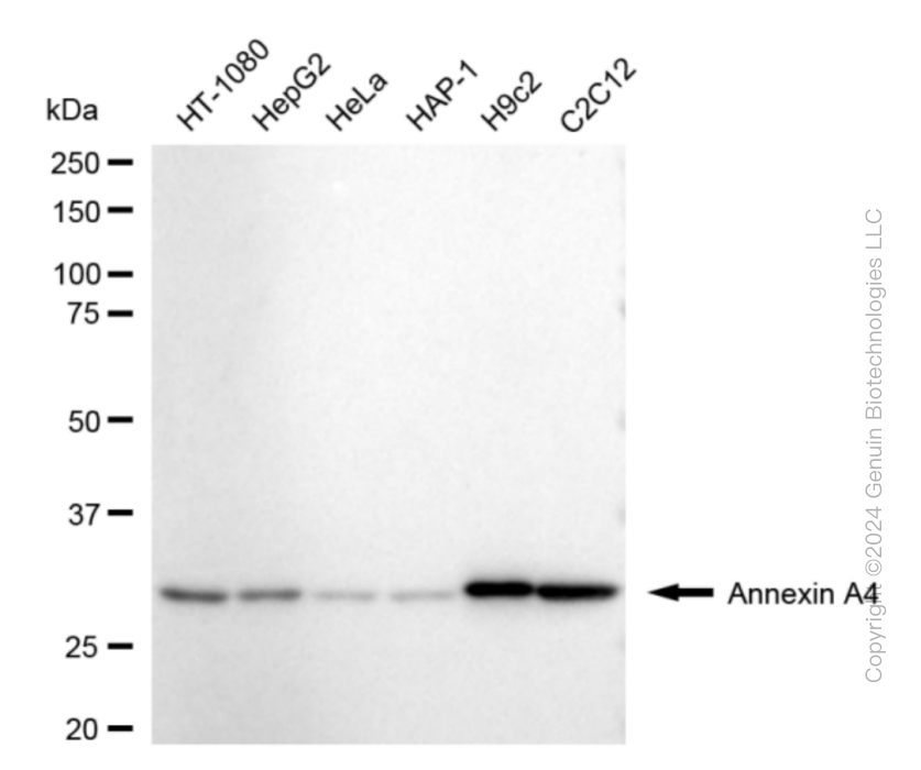 KD-Validated Anti-Annexin 4 Rabbit Monoclonal Antibody ABG1850