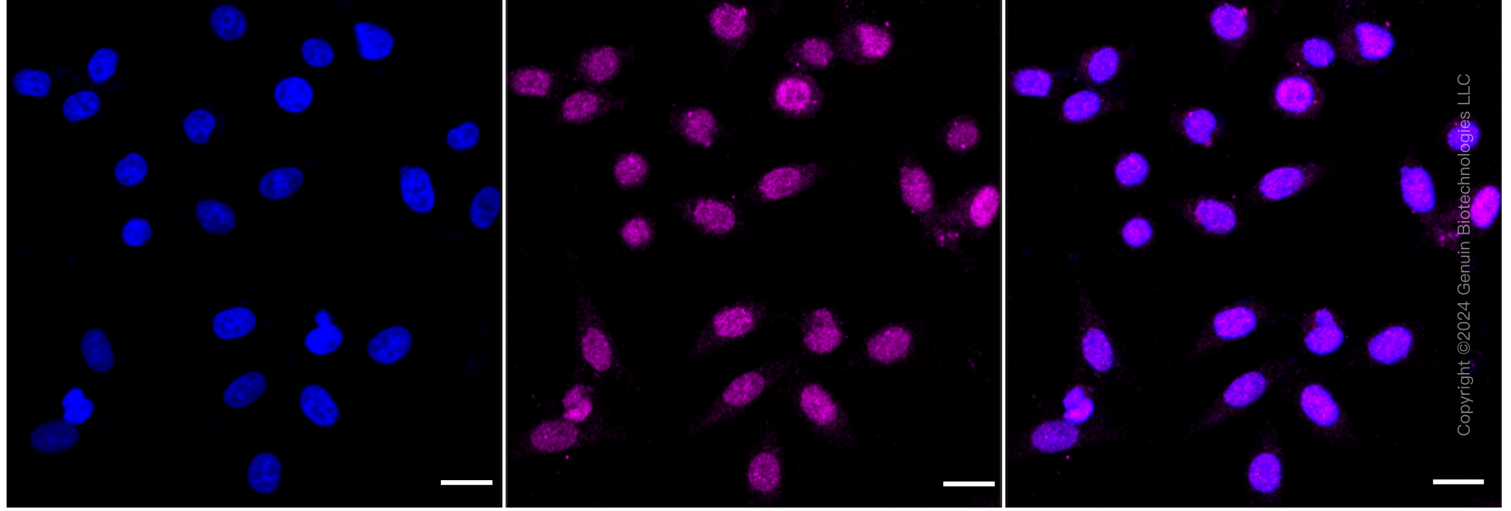 KD-Validated Anti-Arginyltransferase 1 Rabbit Monoclonal Antibody ABG1851