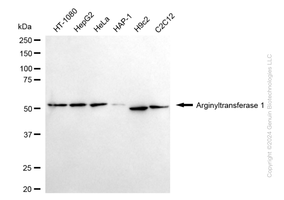 KD-Validated Anti-Arginyltransferase 1 Rabbit Monoclonal Antibody ABG1851