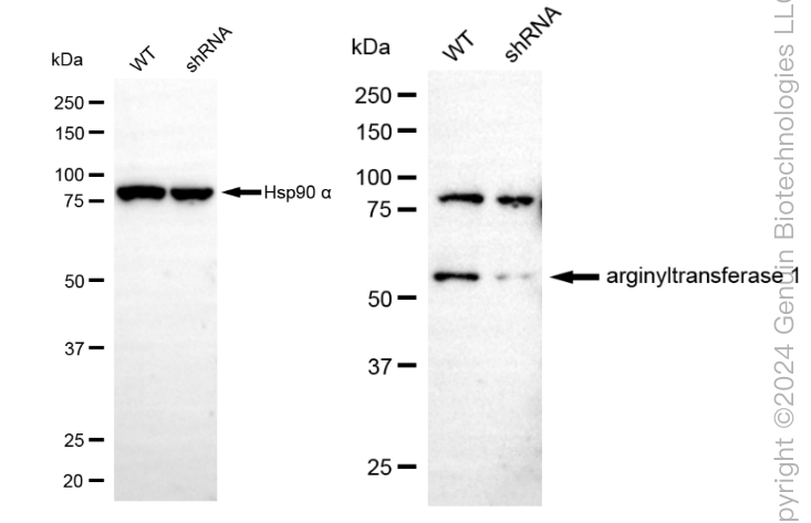 KD-Validated Anti-Arginyltransferase 1 Rabbit Monoclonal Antibody ABG1851